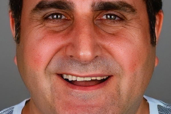 loop - Vorher Nachher - Ahmet Yüksel